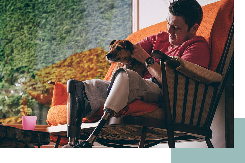 Young man with prosthetic legs sitting with dog on his lap